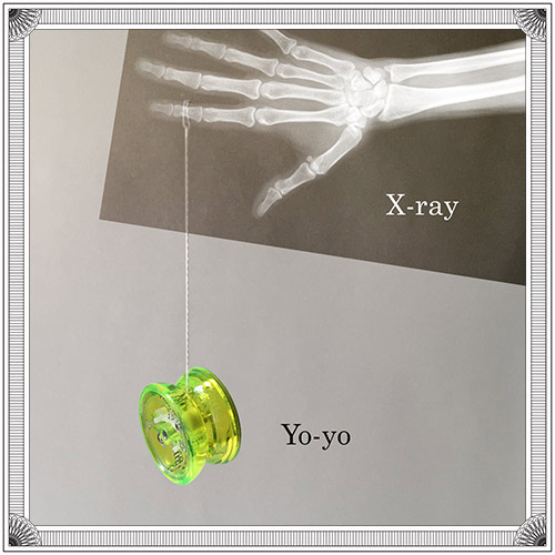 X-Ray, Yo-Yo
